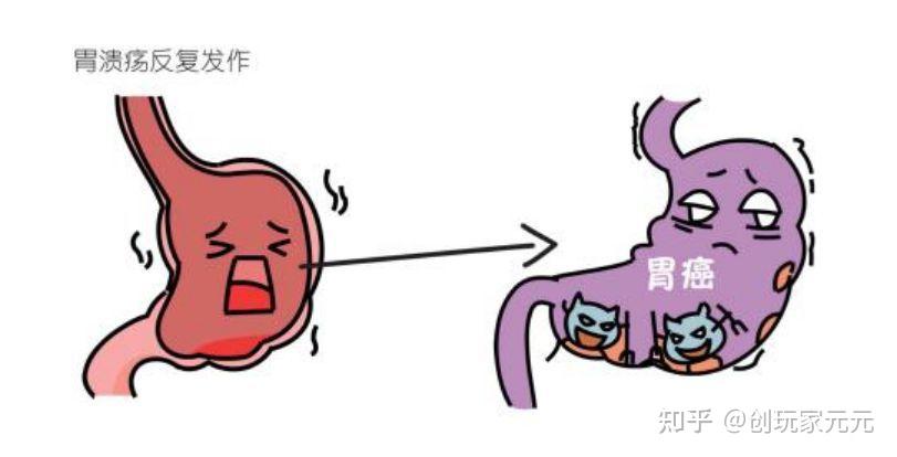 什么是胃穿孔胃溃疡有哪些症状表现怎么预防与治疗胃溃疡