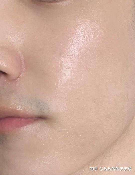 改善皮肤粗糙,细腻毛孔