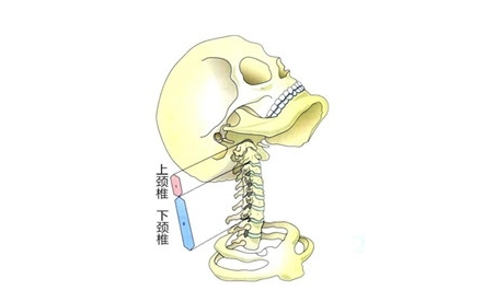 * 什麼是頸椎曲度變直和頸後大包? * 頸曲變直,頸後大包的危害有哪些?