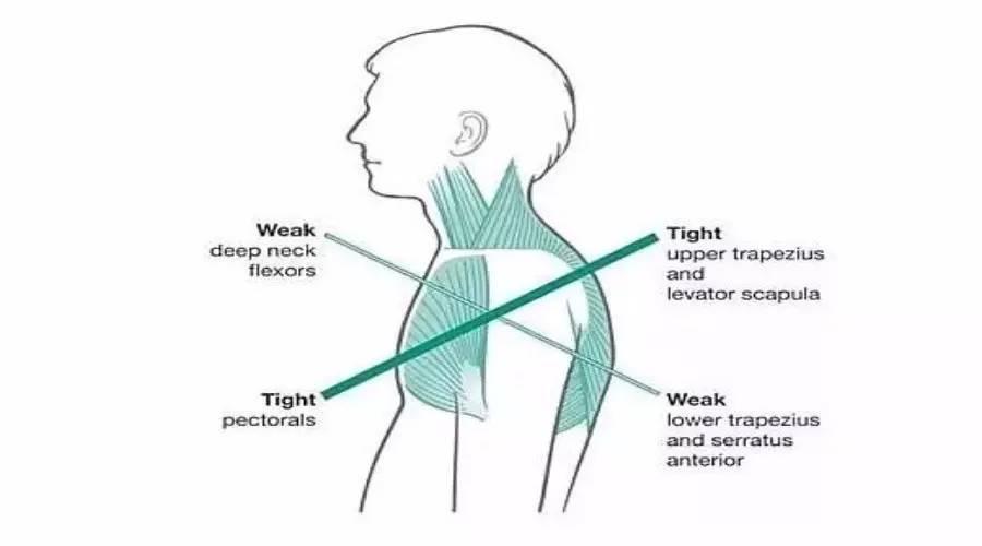 v2-c6f86e9e290a1fafa0d761fcc4dc343e_1440w.jpg?source=172ae18b