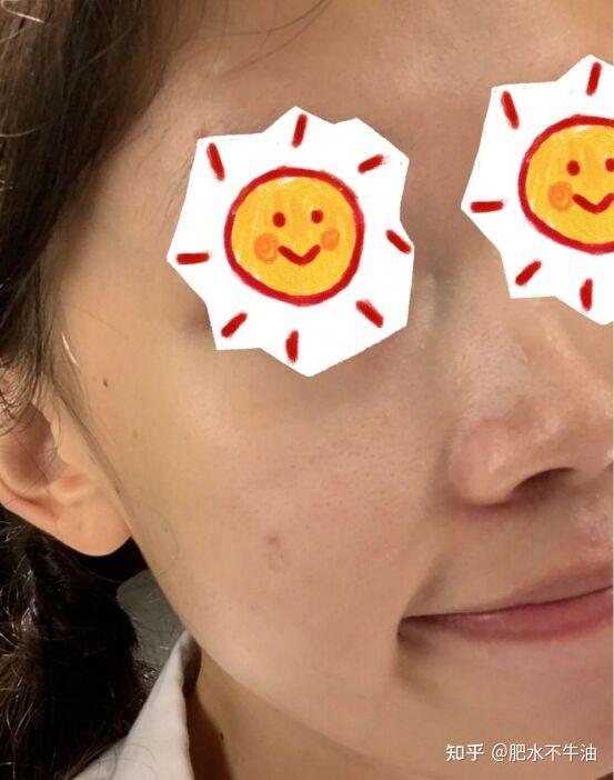 夏天到了怎么防晒和美白