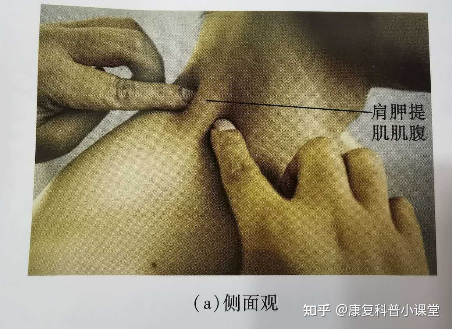 功能解剖学颈肩部肌肉