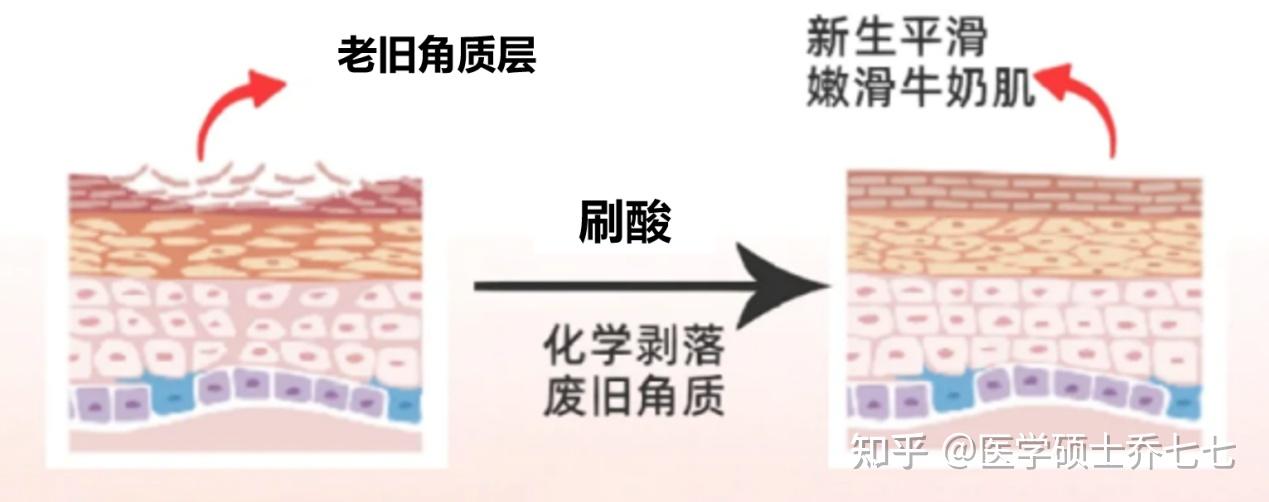 【史上最全刷酸攻略】刷酸真的有用吗?医学硕士手把手教你规范刷酸,解决黑头闭口、粗糙暗沉、毛孔粗大,刷酸新人速速上车!!!