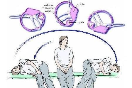 是什么原因引起耳石症 v2-c763de24be16b11118d0df22f7edde43_1440w.jpg?source=172ae18b