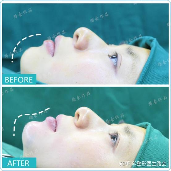 包含中日友好医院最新相关信息黄牛联系方式的词条