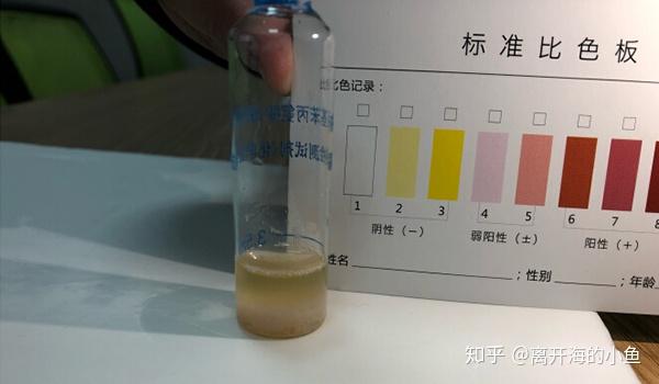 宅测尿液检测试纸真的能检查出癌症癌症会传染