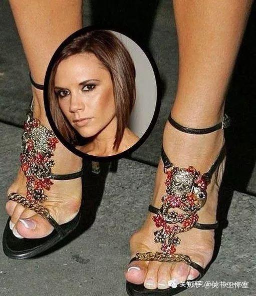 外翻"患者欲戴王冠,必承其重被称为 高跟鞋女王"辣妹"维多利亚是欧洲
