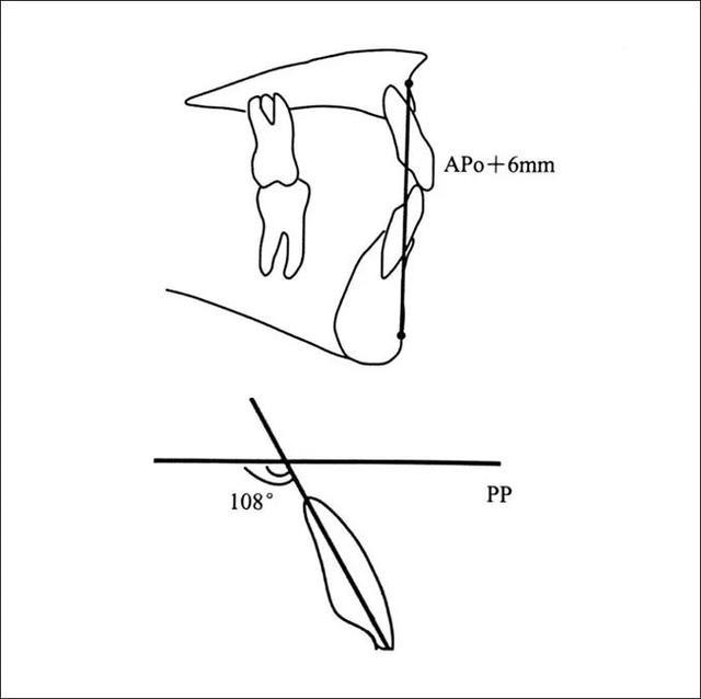 北京牙齿矫正有哪些医院推荐价格多少钱合适骨性嘴凸牙齿矫正可以改善