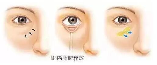 v2-c7fb13a85577a7bf79aa9e50665a7e99_1440w.jpg?source=172ae18b