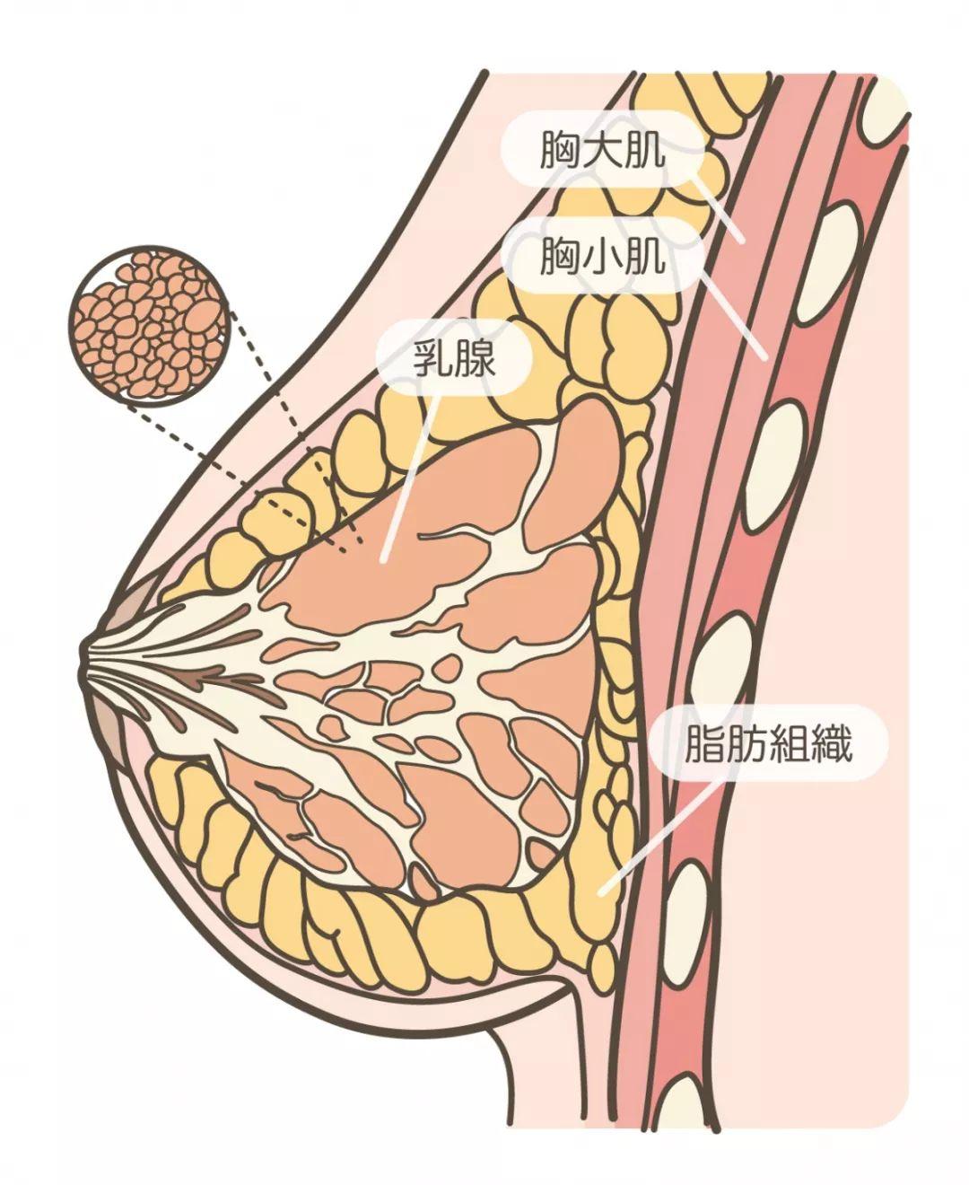 自体脂肪丰胸有什么后遗症吗?