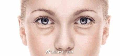 v2-c85b2918fe5c382f5e86296303cf77ee_1440w.jpg?source=172ae18b