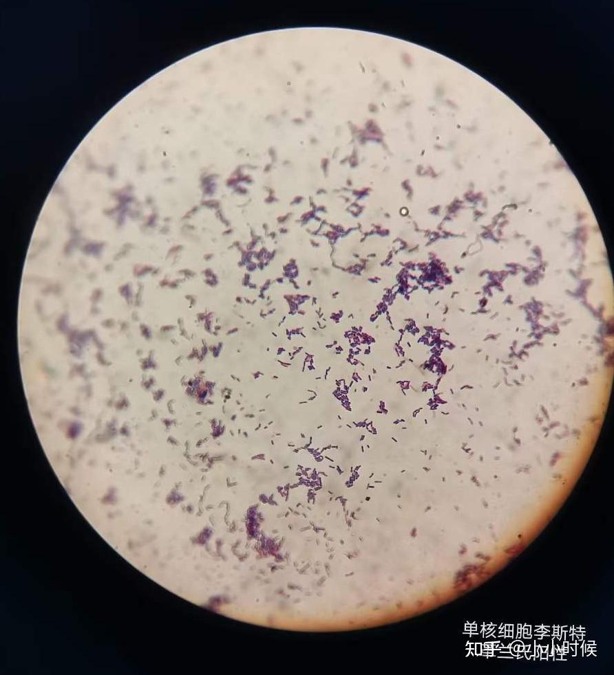 八叠球菌革兰氏染色图片