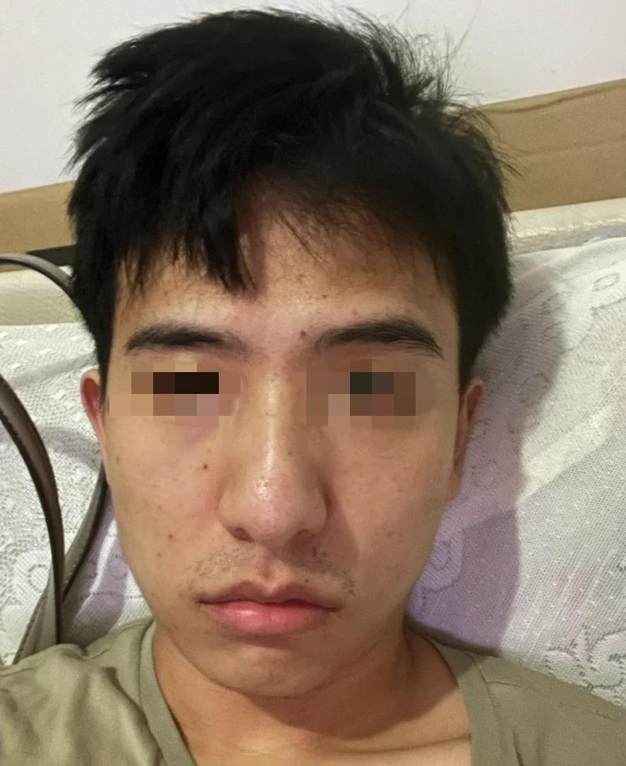 男生又黄又黑,肤色暗沉,如何短时间内美白不反复?【化妆配方狗】高效男士美白教程,3步30天帮你养回“小白脸”! - 知乎