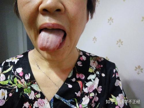 身体好不好看看舌头就知道