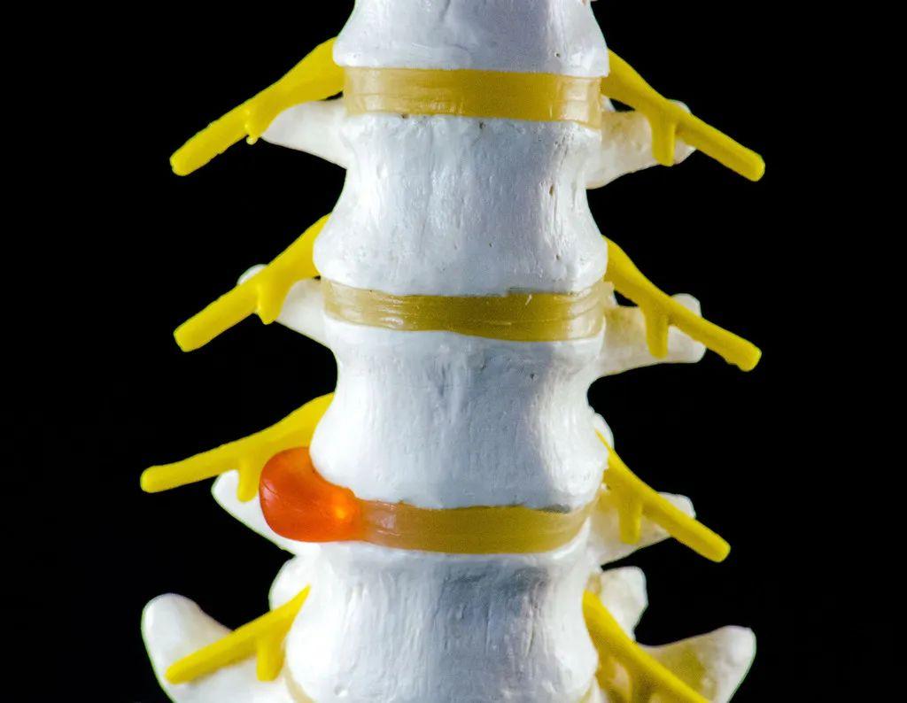榜单Top.1 | 骨水泥搅拌器+骨水泥填充器 - 知乎