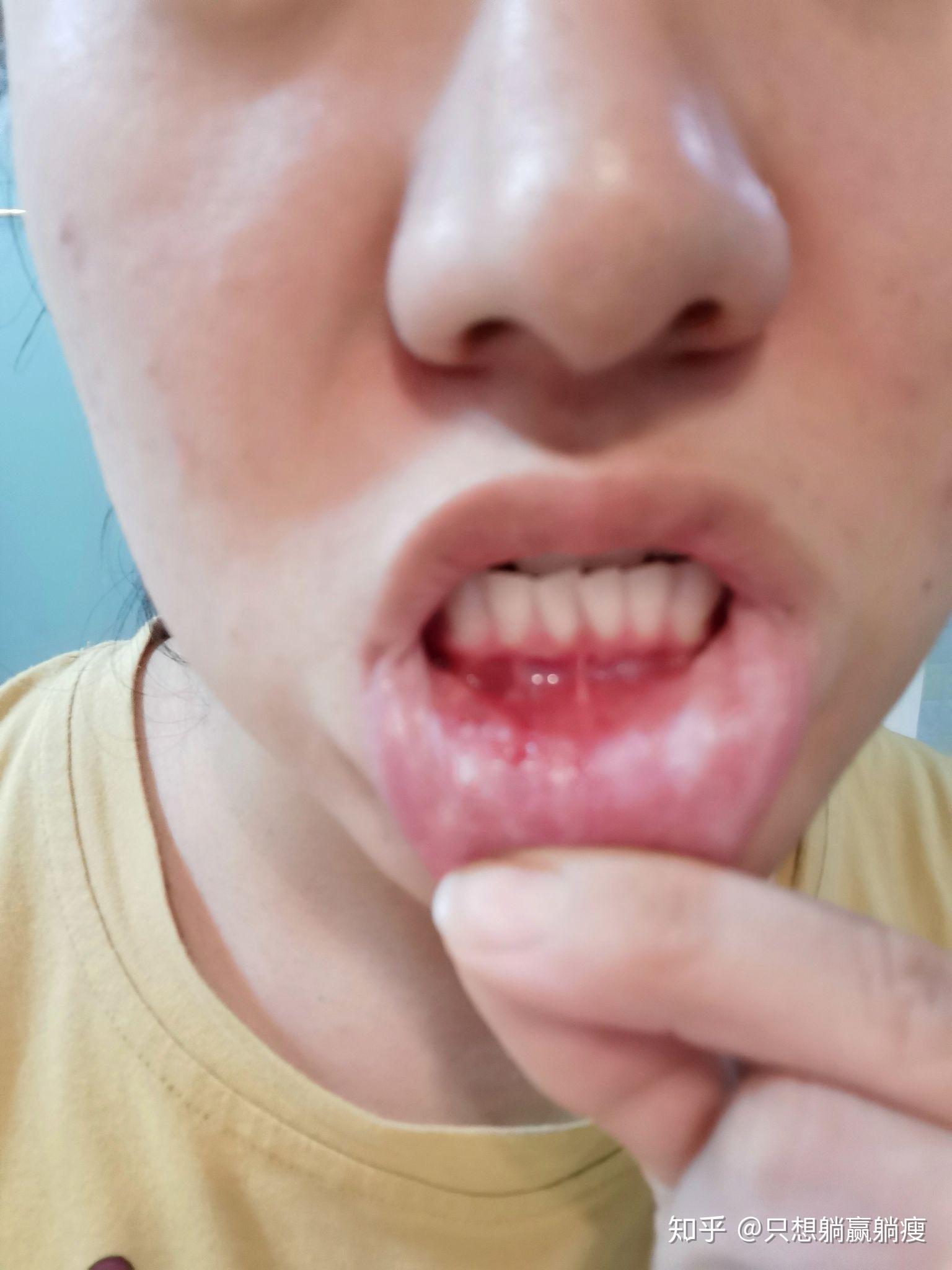 谁能救救我完全控制不住自己的强迫症