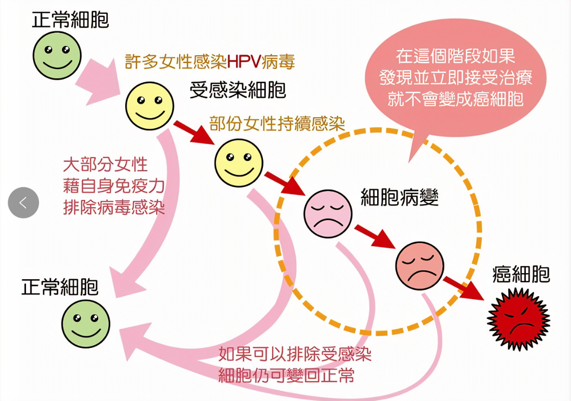 硬核科普丨跖疣hpv与宫颈癌