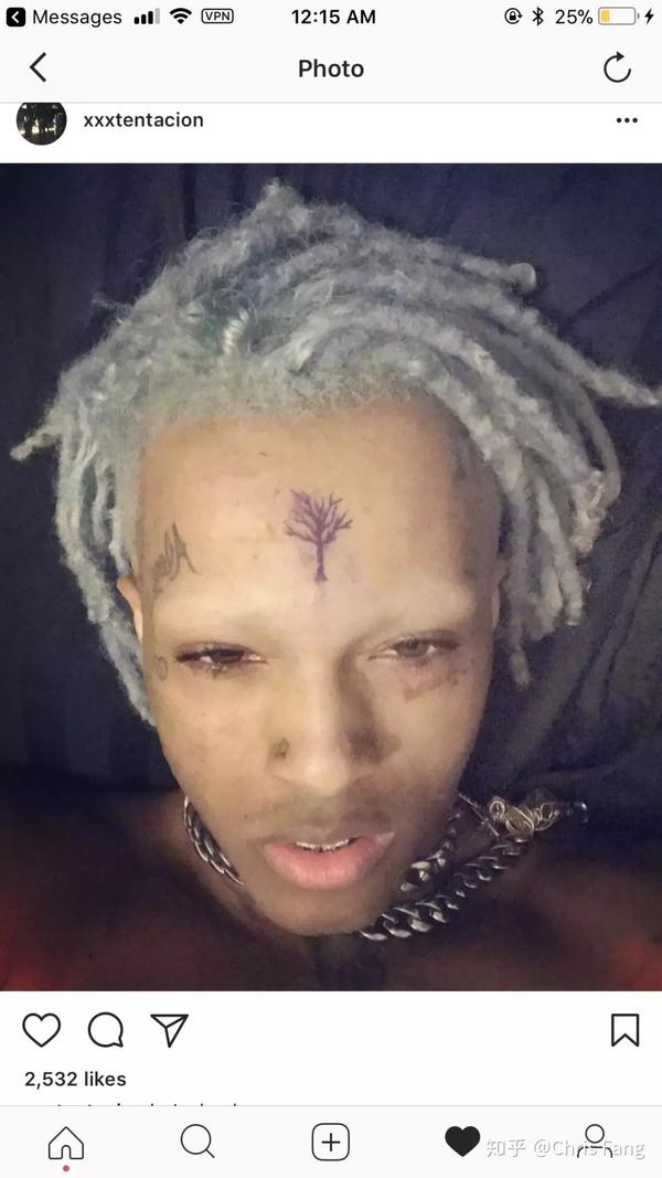 Xxxtentacion 死因