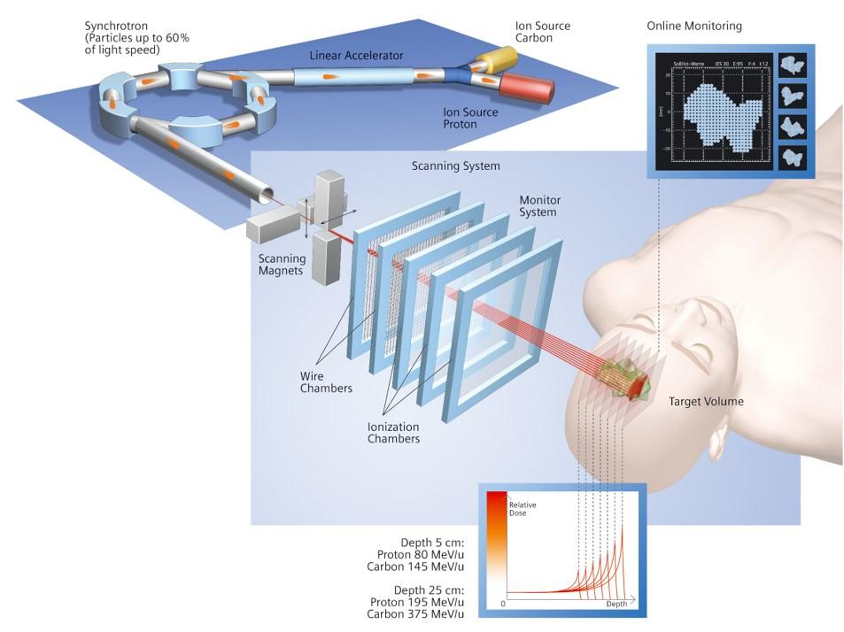 一文读懂肿瘤重离子碳离子放疗
