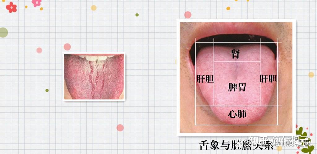 舌头有裂纹,齿痕?6种常见舌象的调理方法,看看你属于哪一种? - 知乎