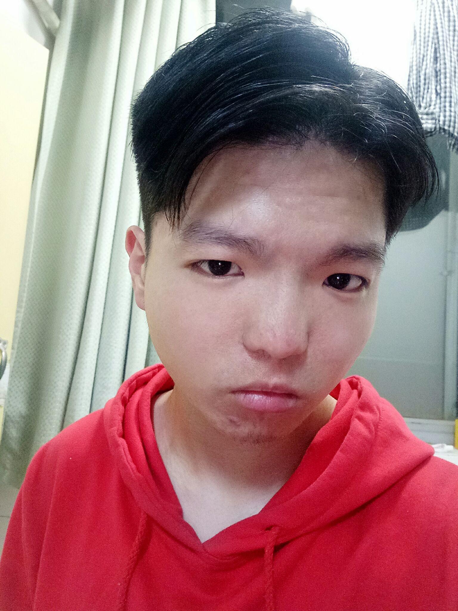 男孩由帅变丑是种怎样的体验