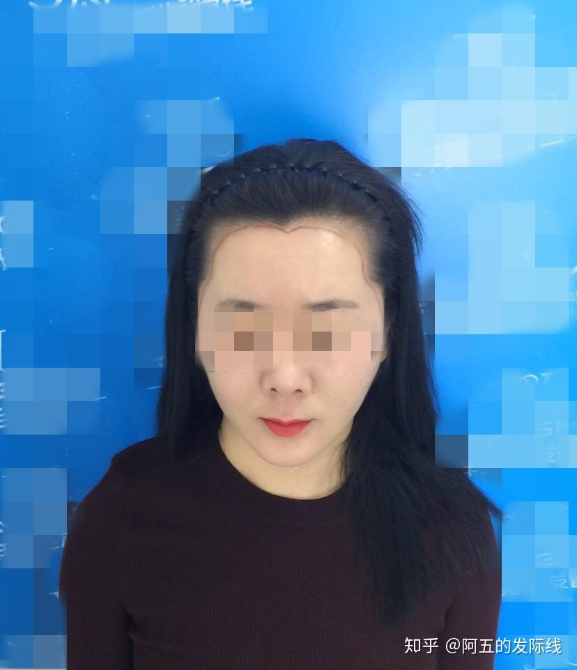 v2-c93fee811aa6d7fb474f11d24cd513d2_r.jpg