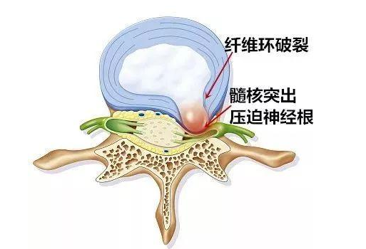v2-c9663dbf50893ec187580f3e8ab118aa_1440w.jpg?source=172ae18b