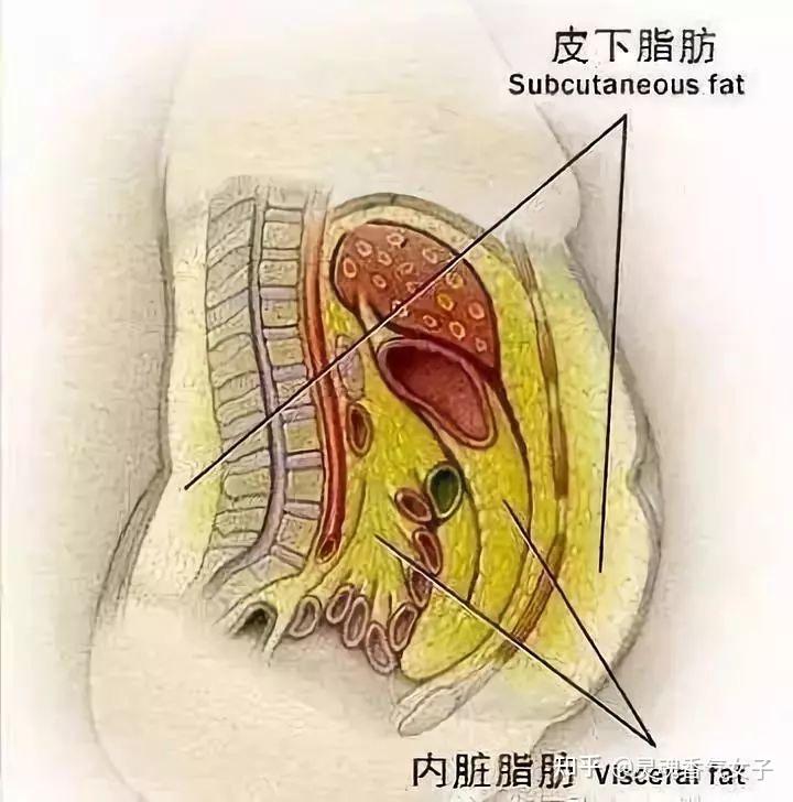 胖人的血管脂肪图片图片