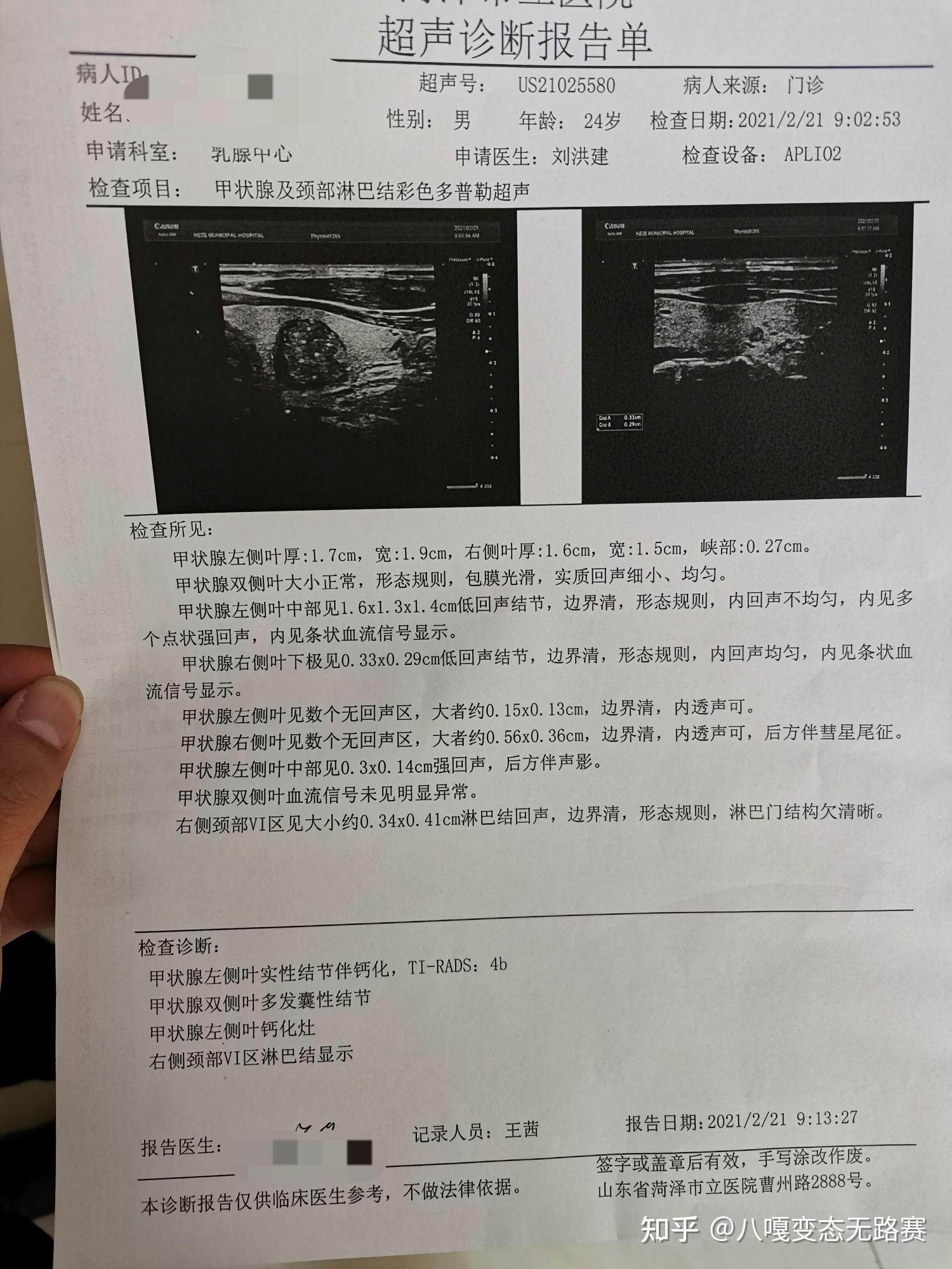 甲状腺乳头状癌就诊记录