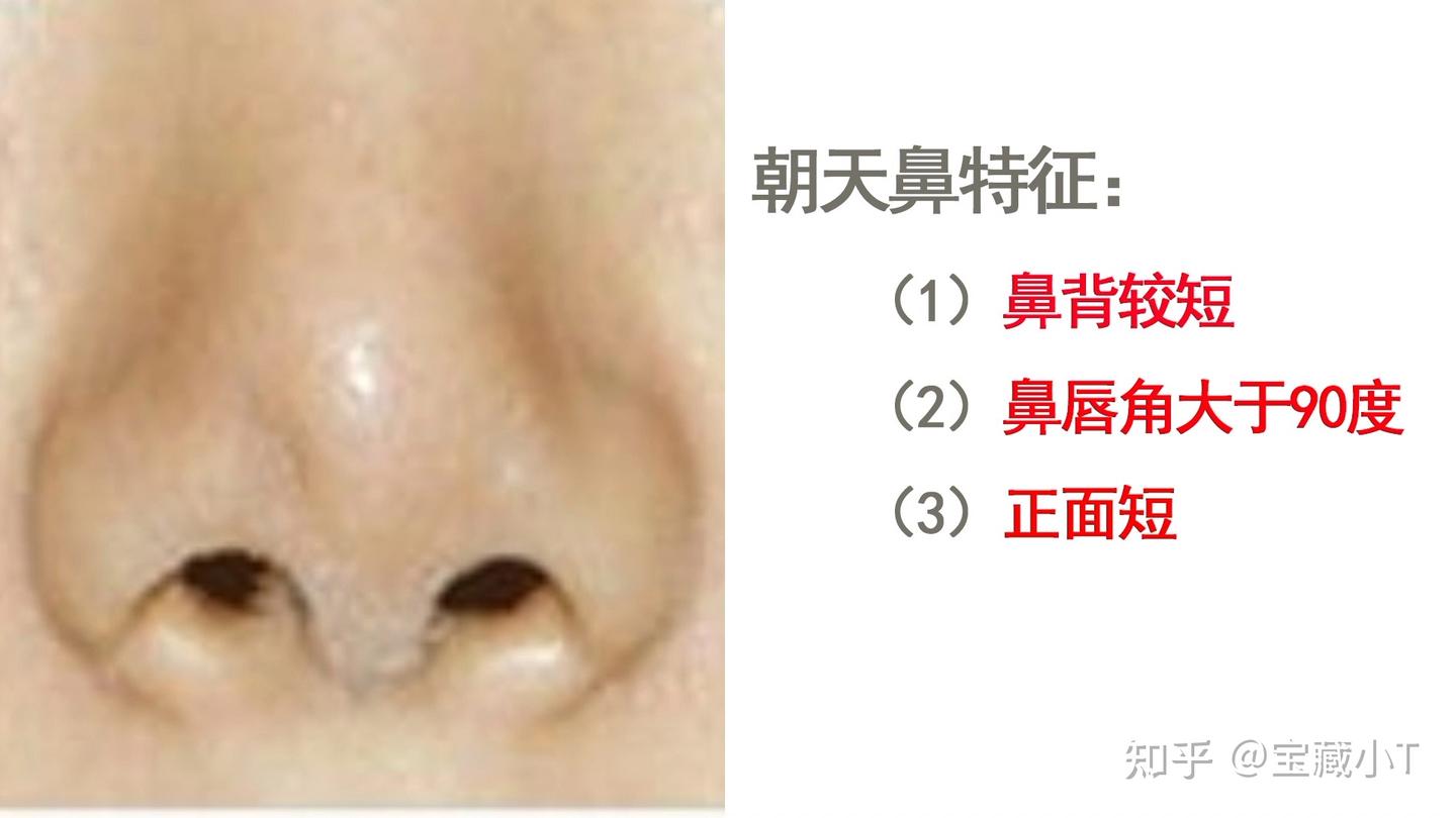 五大常见鼻型,你属于哪一种? - 知乎