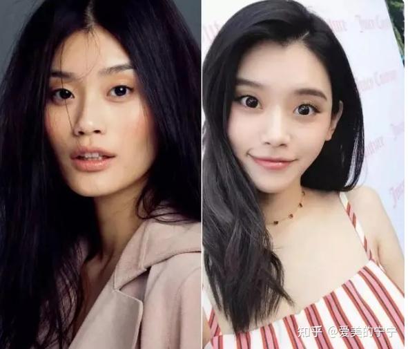 从苦相脸到幼态脸,奚梦瑶到底动了哪里?【善美宁微整形】 - 知乎
