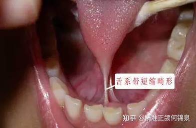 v2-c9fb005d2f6ee0bf9fa7aed163a1efc2_b.jpg