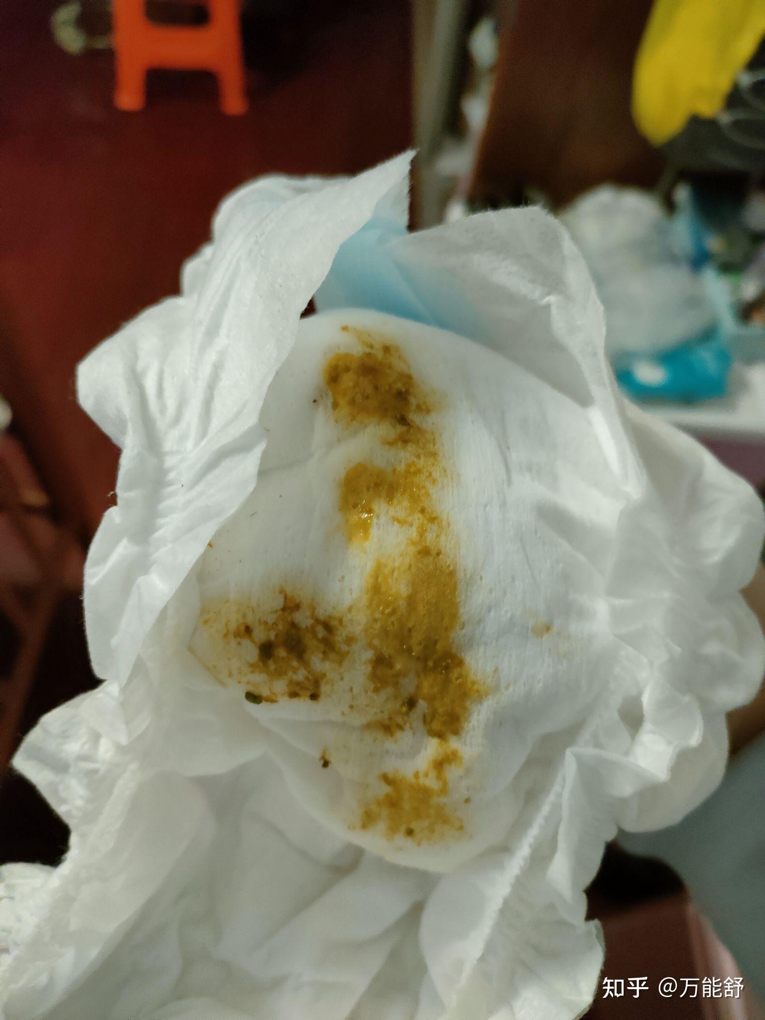 蛋白过敏粑粑会有血丝,和乳糖不耐受情况不一样,但是有些蛋白过敏的