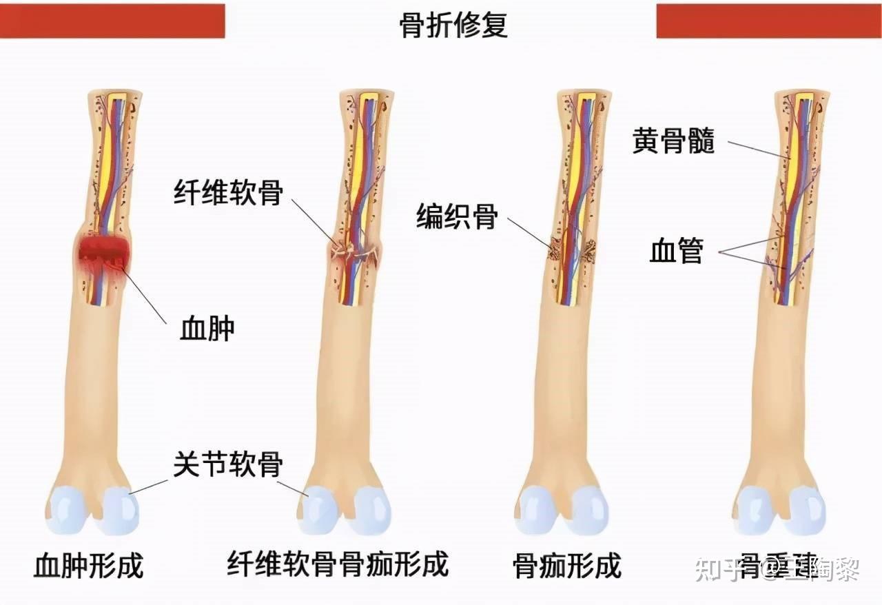 为什么骨折愈合这么久?