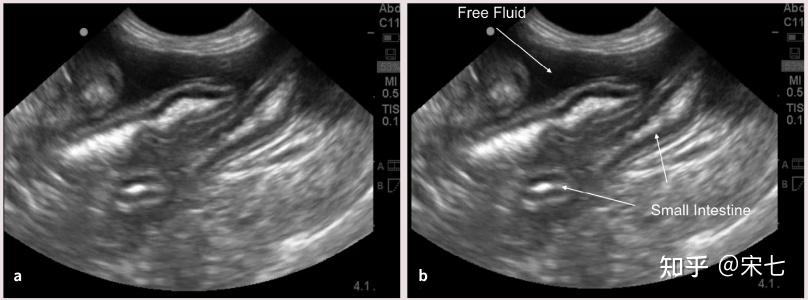 猫传腹(fip)的影像诊断