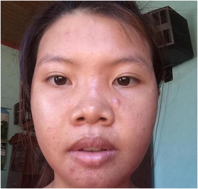 越南22岁丑女花十万整容最后嫁入豪门