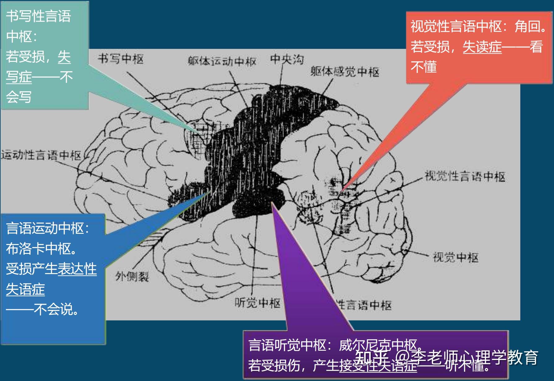 威尔尼克中枢图片