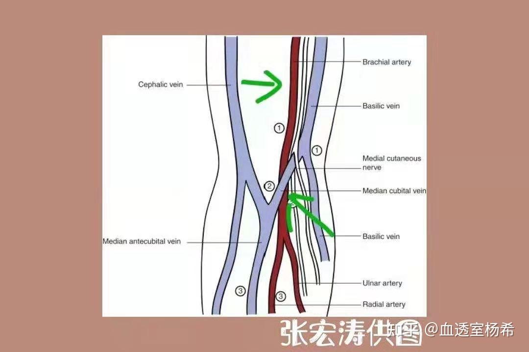 肱动脉与贵要静脉的毗邻关系因为肘关节贵要静脉下方就是肱动脉,如果