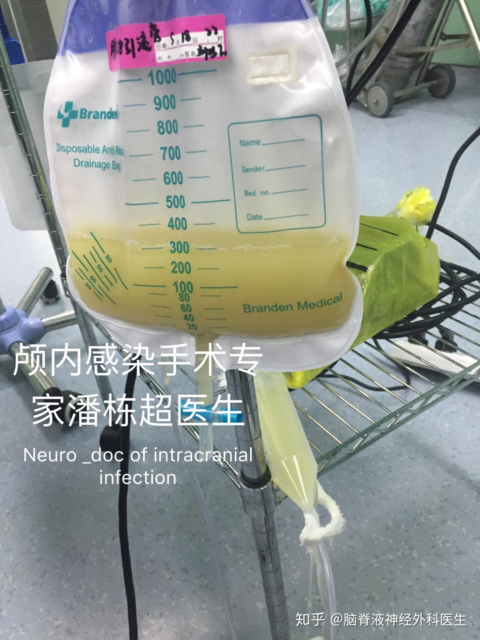 严重化脓性颅内感染病例