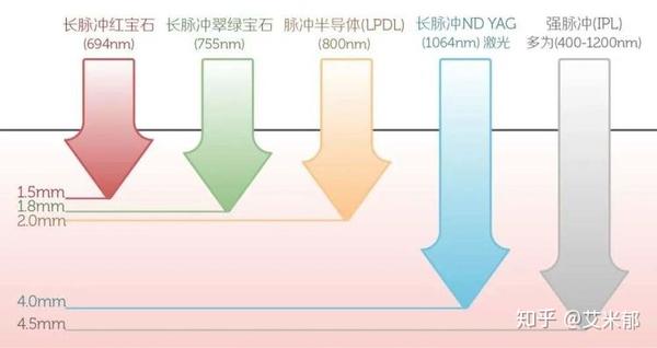 激光脱毛机器有多少种 怎么选 知乎