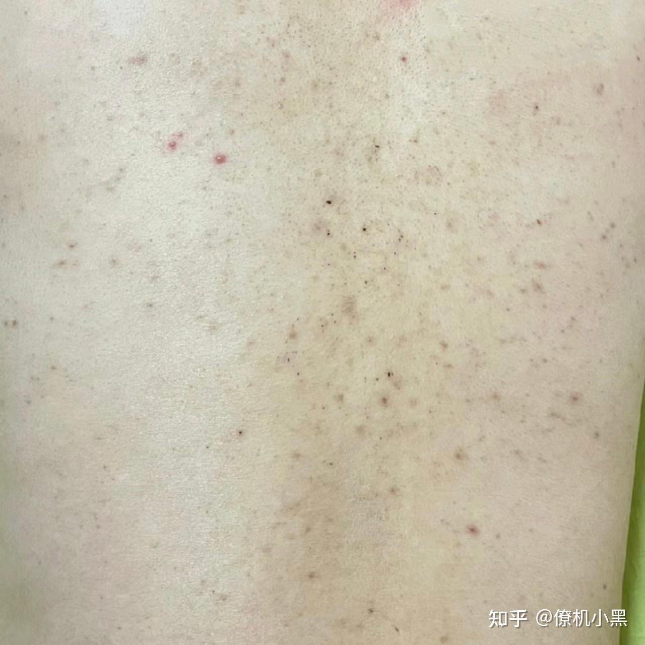 v2-cb100fad1062c62238cf1ba17a51174a_r.jpg