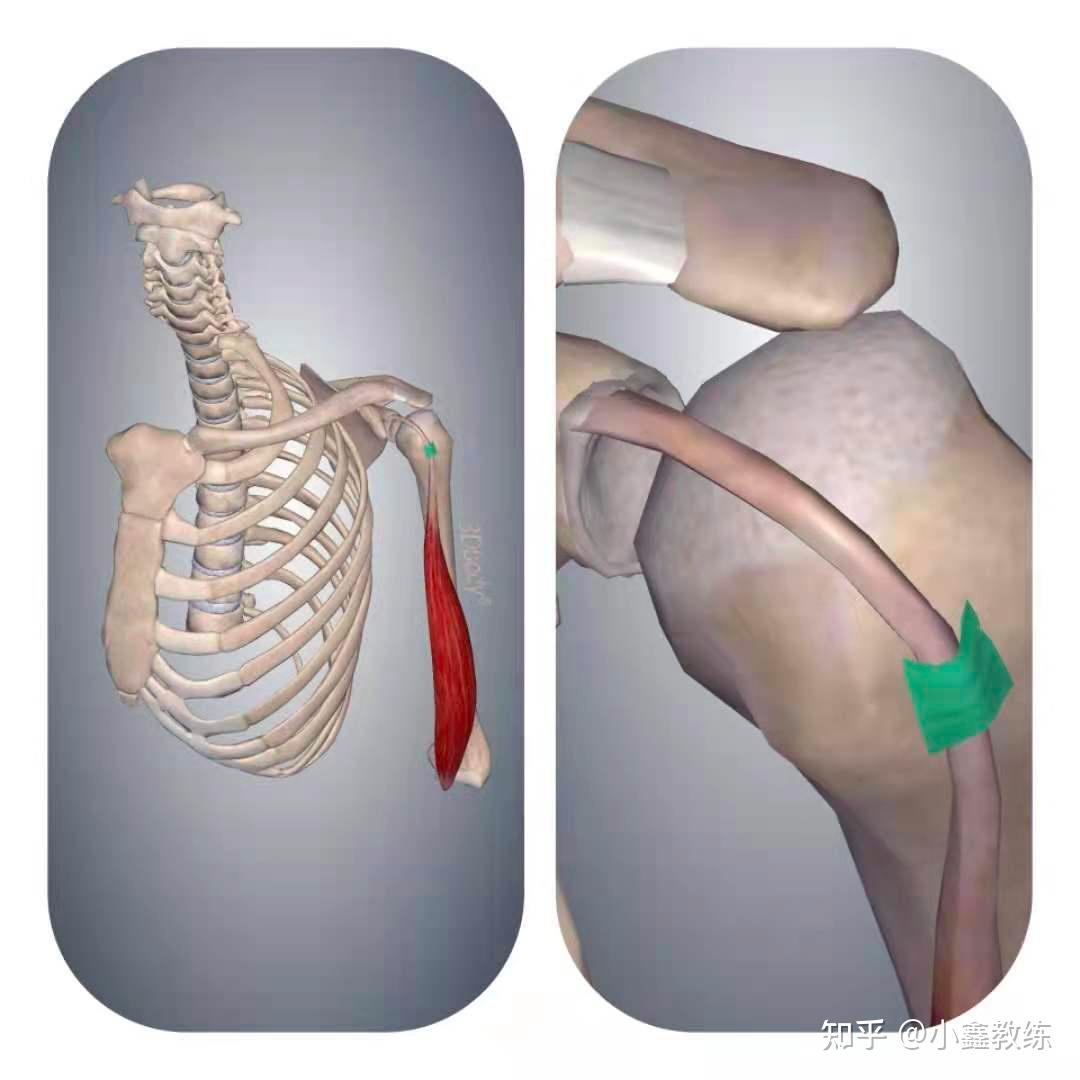 喙肱肌肌腱炎图片