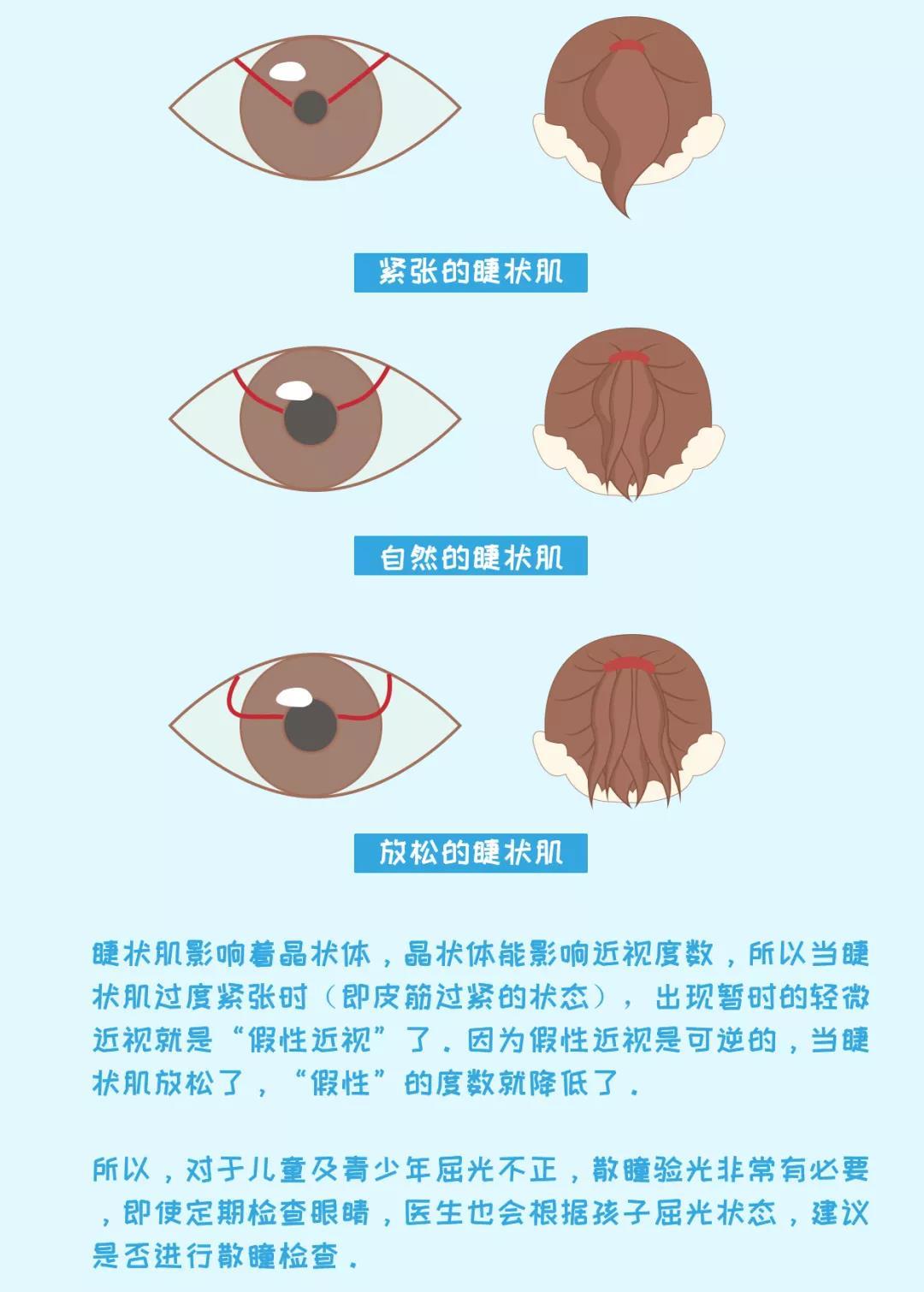 目前,很多眼镜店是没有"散瞳验光"这一步骤的,为了孩子的视力着想建议