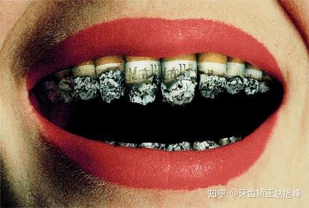 抽烟人烂牙？ 看得我瑟瑟发抖 - 知乎