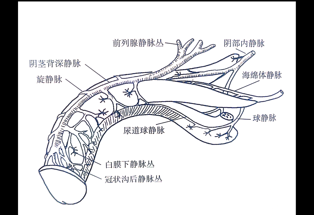 阴痉静脉纤维化图片