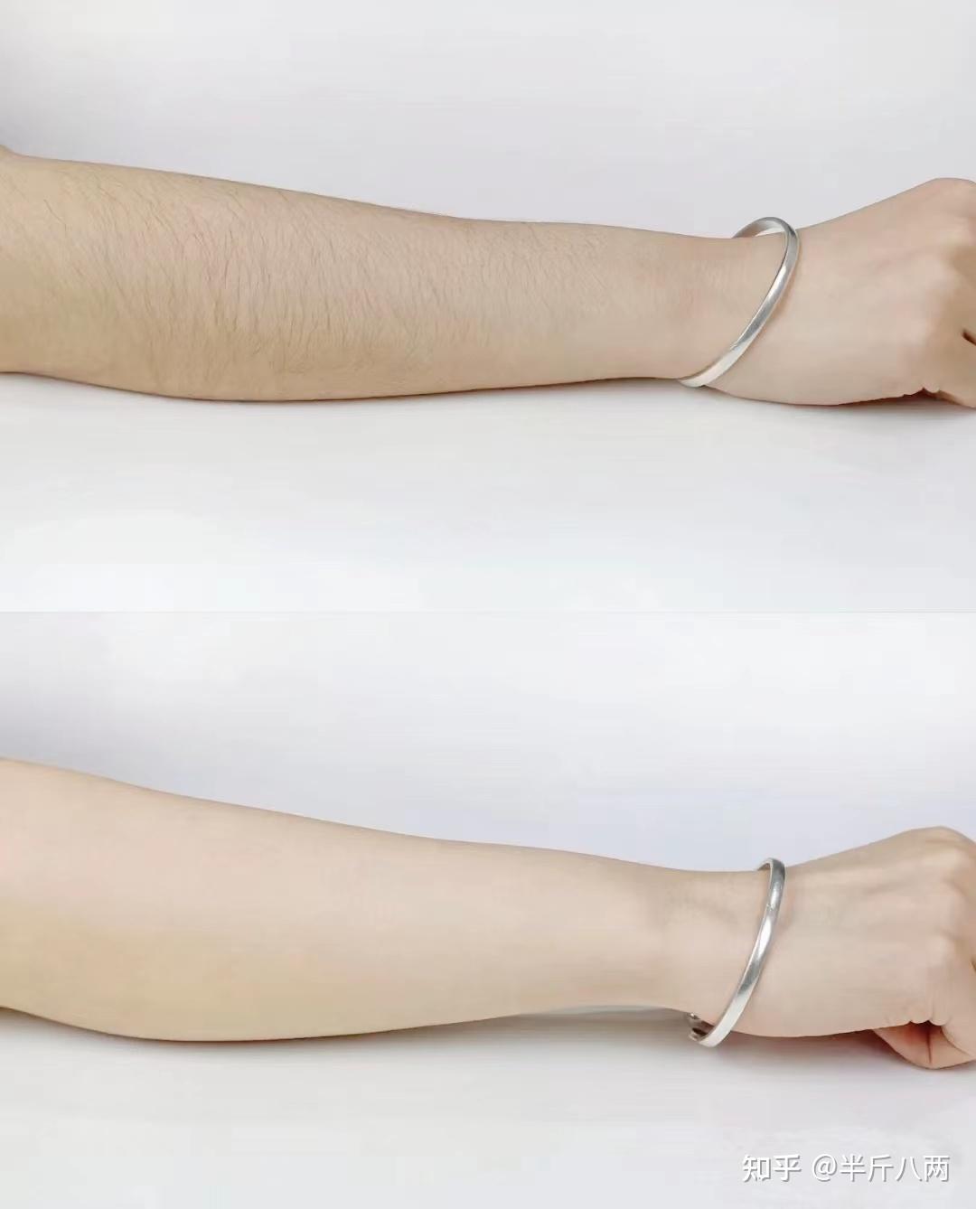 夏天到了有什么让皮肤光滑白皙的好方法ulike脱毛仪实测