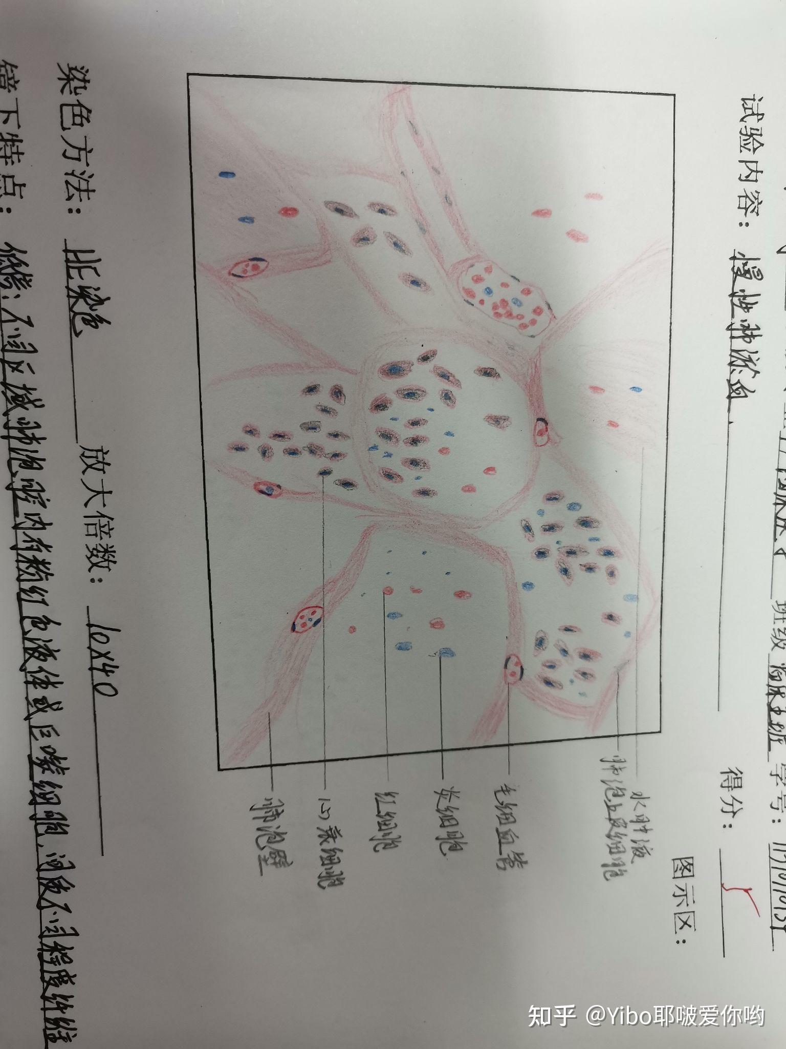 平滑肌肉瘤红蓝铅笔图图片