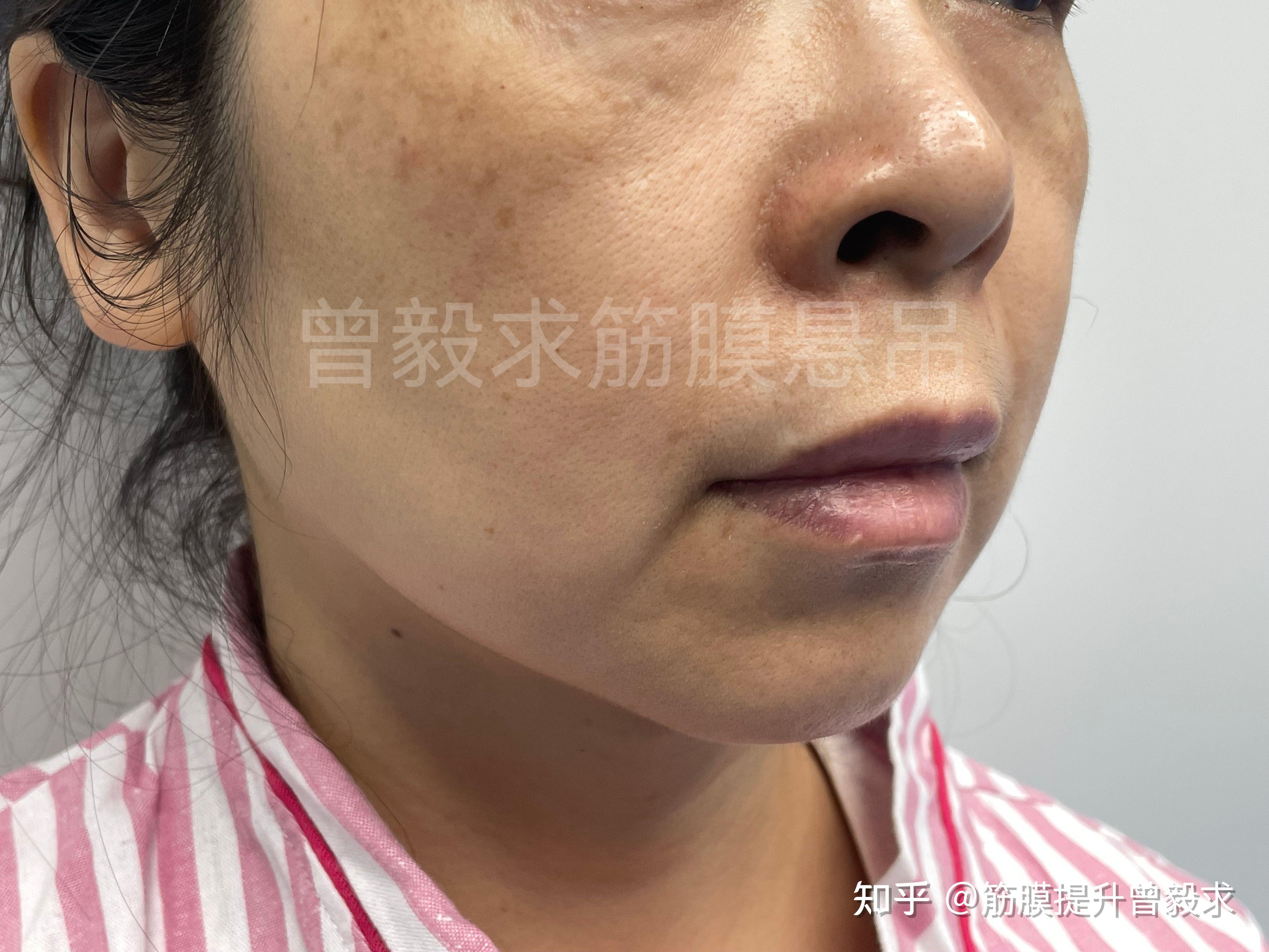 面部提升术：日本「美魔女大赛」52岁阿姨颜值逆天夺冠！