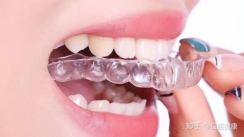 久的牙套,一直配合医生的治疗,所以一定要好好戴保持器才不会功亏一篑