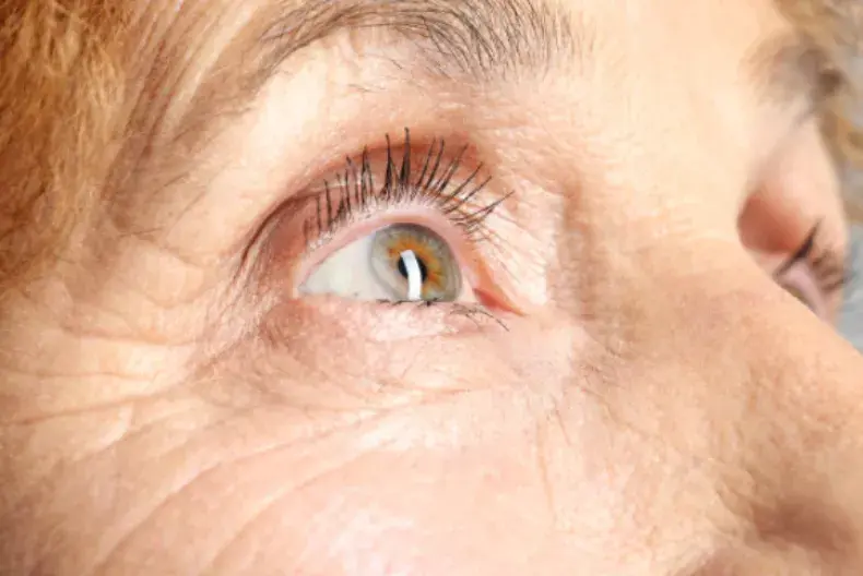 全球首款老花眼滴眼液获fda批准,每次使用效果可持续6小时